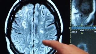 Radiografía del cerebro.