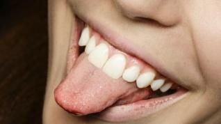 Conviene limpiar la lengua al menos dos veces al d&iacute;a.
